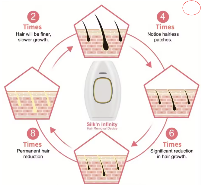 Depiladora Laser - LUXIOTECH™