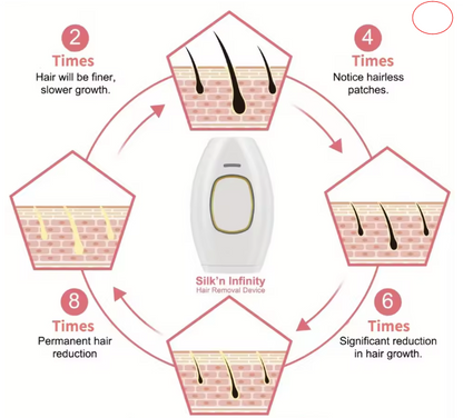 Depiladora Laser - LUXIOTECH™